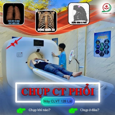 Chụp cắt lớp vi tính Phổi